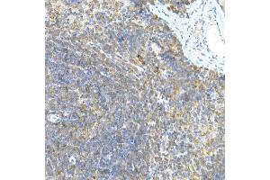 Immunohistochemistry of paraffin-embedded rat brain using LGR5/GPR49 Rabbit pAb  at dilution of 1:300 (40x lens). (LGR5 Antikörper  (AA 824-907))