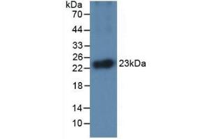 Detection of Recombinant IL1a, Equine using Monoclonal Antibody to Interleukin 1 Alpha (IL1a) (IL1A Antikörper  (AA 95-269))