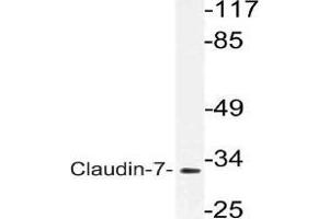 Western blot (WB) analysis of VDR antibody in extracts from rat liver cells. (Claudin 7 Antikörper)
