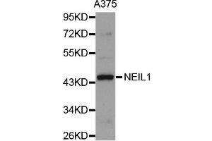 Western blot analysis of extracts of A375 cell line, using NEIL1 antibody. (NEIL1 Antikörper)