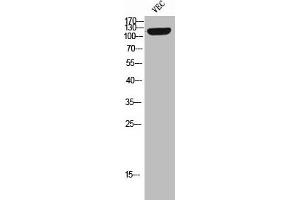 Western Blot analysis of VEC cells using Phospho-Tie-2 (Y992) Polyclonal Antibody (TEK Antikörper  (pTyr992))