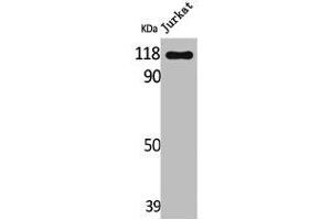 Western Blot analysis of Jurkat cells using Lfc Polyclonal Antibody (ARHGEF2 Antikörper)