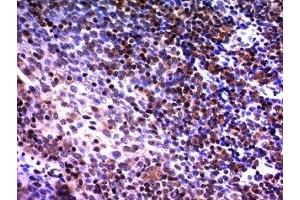 Formalin-fixed, paraffin-embedded human tonsil stained with NuMA antibody (A73-B/D12) (NUMA1 Antikörper)