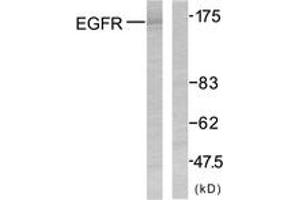 Western blot analysis of extracts from SK-OV3 cells, using EGFR (Ab-1070) Antibody. (EGFR Antikörper  (AA 1041-1090))
