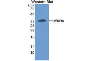 Western Blotting (WB) image for anti-Carcinoembryonic Antigen-Related Cell Adhesion Molecule 1 (CEACAM1) (AA 35-320) antibody (ABIN3201732) (CEACAM1 Antikörper  (AA 35-320))