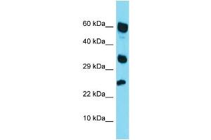 Western Blotting (WB) image for anti-Retinoic Acid Receptor Responder (Tazarotene Induced) 1 (RARRES1) (Middle Region) antibody (ABIN2499940) (RARRES1 Antikörper  (Middle Region))