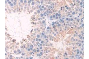 Detection of TNFR1 in Mouse Testis Tissue using Polyclonal Antibody to Tumor Necrosis Factor Receptor 1 (TNFR1) (TNFRSF1A Antikörper  (AA 239-433))