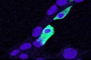 Immunofluorescence (IF) image for anti-Chloride Intracellular Channel 4 (CLIC4) antibody (ABIN5861496) (CLIC4 Antikörper)