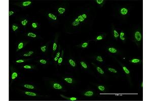 Immunofluorescence of monoclonal antibody to OXSR1 on HeLa cell. (OXSR1 Antikörper  (AA 351-450))