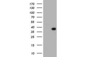 HEK293T cells were transfected with the pCMV6-ENTRY control (Left lane) or pCMV6-ENTRY LRRC39 (Right lane) cDNA for 48 hrs and lysed. (LRRC39 Antikörper)