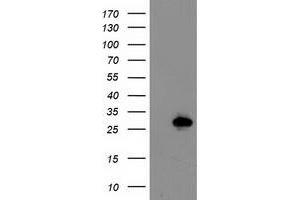 HEK293T cells were transfected with the pCMV6-ENTRY control (Left lane) or pCMV6-ENTRY LXN (Right lane) cDNA for 48 hrs and lysed. (Latexin Antikörper)