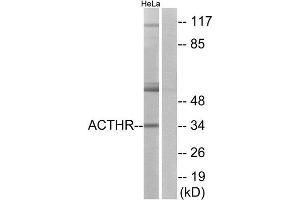 Western Blotting (WB) image for anti-Melanocortin 2 Receptor (Adrenocorticotropic Hormone) (MC2R) (C-Term) antibody (ABIN1852923) (MC2R Antikörper  (C-Term))