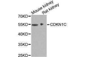Western blot analysis of extracts of various cell lines, using CDKN1C antibody (ABIN1871758) at 1:1000 dilution. (CDKN1C Antikörper)