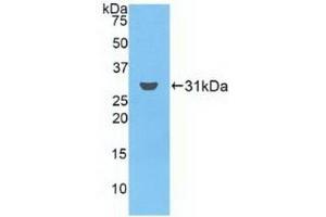 Detection of Recombinant FCN3, Human using Polyclonal Antibody to Ficolin 3 (FCN3) (FCN3 Antikörper  (AA 34-297))