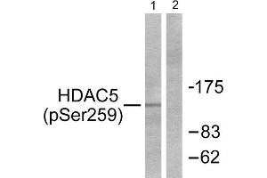 Western Blotting (WB) image for anti-Histone Deacetylase 5 (HDAC5) (pSer259) antibody (ABIN1847263) (HDAC5 Antikörper  (pSer259))