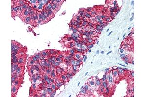 Anti-CD38 antibody IHC of human prostate. (CD38 Antikörper  (C-Term))