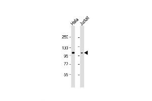 Western Blot at 1:8000 dilution Lane 1: Hela whole cell lysate Lane 2: Jurkat whole cell lysate Lysates/proteins at 20 ug per lane. (Retinoblastoma 1 Antikörper  (C-Term))