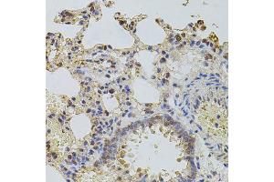 Immunohistochemistry of paraffin-embedded rat lung using PLK4 antibody (ABIN6003595) at dilution of 1/100 (40x lens). (PLK4 Antikörper)