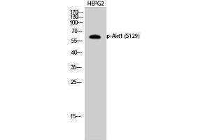 Western Blotting (WB) image for anti-V-Akt Murine Thymoma Viral Oncogene Homolog 1 (AKT1) (pSer129) antibody (ABIN3182221) (AKT1 Antikörper  (pSer129))