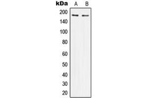 Western blot analysis of IRS1 expression in HeLa (A), HEK293 (B) whole cell lysates. (IRS1 Antikörper  (Center))