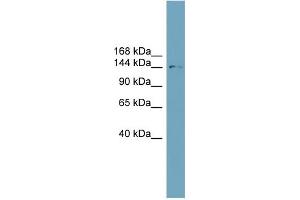 WB Suggested Anti-SLC4A2 Antibody Titration: 0. (SLC4A2 Antikörper  (N-Term))