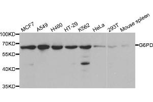 Western blot analysis of extracts of various cell lines, using G6PD antibody (ABIN5970726) at 1/1000 dilution. (Glucose-6-Phosphate Dehydrogenase Antikörper)