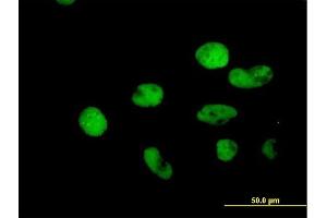 Immunofluorescence of purified MaxPab antibody to MSH2 on HeLa cell. (MSH2 Antikörper  (AA 1-934))