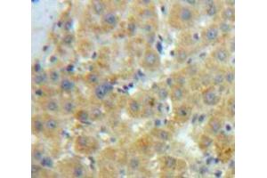 Used in DAB staining on fromalin fixed paraffin-embedded Liver tissue (Caldesmon Antikörper  (AA 28-207))