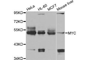 Western blot analysis of extracts of various cell lines, using MYC antibody (ABIN5996012) at 1/1000 dilution. (c-MYC Antikörper)