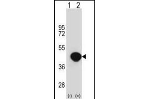 Western blot analysis of BGN (arrow) using rabbit polyclonal BGN Antibody (Center) (ABIN390701 and ABIN2840987). (Biglycan Antikörper  (AA 148-176))