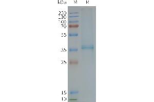 Human -Nanodisc, Flag Tag on SDS-PAGE (XCR1 Protein)