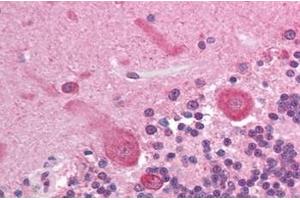 Immunohistochemistry (IHC) image for anti-V-Akt Murine Thymoma Viral Oncogene Homolog 3 (Protein Kinase B, Gamma) (AKT3) (AA 119-136) antibody (ABIN302246) (AKT3 Antikörper  (AA 119-136))