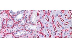 Immunohistochemistry (IHC) image for anti-Collagen, Type IV (COL4) antibody (ABIN5596835)