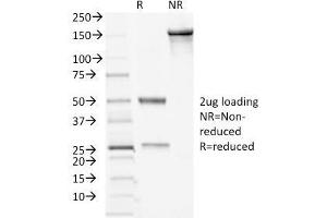 SDS-PAGE Analysis Purified Desmocollin-2/3 Mouse Monoclonal Antibody (7G6). (Desmocollin 2 Antikörper  (Extracellular Domain))