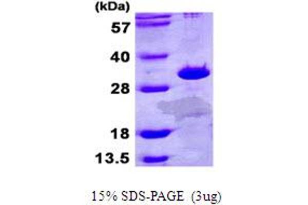 ETFB Protein (AA 1-255) (His tag)