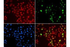 Immunofluorescence analysis of GFP-RNF168 transgenic U2OS cells using POLH antibody (ABIN5970934). (POLH Antikörper)