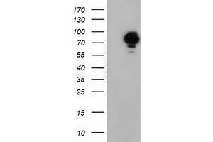 HEK293T cells were transfected with the pCMV6-ENTRY control (Left lane) or pCMV6-ENTRY VWA5A (Right lane) cDNA for 48 hrs and lysed. (VWA5A Antikörper)