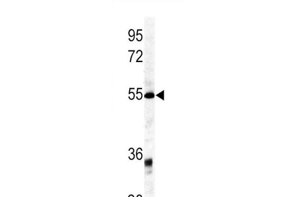 GDF6 Antikörper  (C-Term)