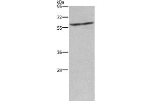 Western Blot analysis of Mouse liver tissue using CYP4A11 Polyclonal Antibody at dilution of 1:250 (CYP4A11 Antikörper)