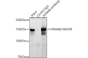 Immunoprecipitation analysis of 300 μg extracts of HCT116 cells using 3 μg KDM4B/JMJD2B antibody (ABIN7268329). (KDM4B Antikörper)