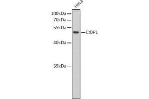 Western blot analysis of extracts of HeLa cells, using CtBP1 antibody (ABIN6127531, ABIN6139177, ABIN6139178 and ABIN6220177). (CTBP1 Antikörper  (AA 20-250))