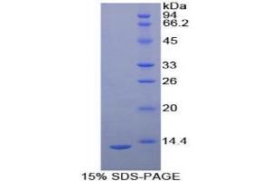 SDS-PAGE analysis of Human uPAR Protein. (PLAUR Protein)