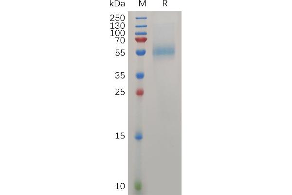 Zona Pellucida Glycoprotein 3 Protein (ZP3) (AA 23-386) (His tag)