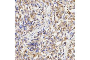 Immunohistochemistry (IHC) image for anti-Kinesin Light Chain 1 (KLC1) antibody (ABIN1876732) (KLC1 Antikörper)