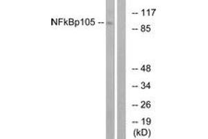 Western blot analysis of extracts from HeLa cells, treated with CA+TNF 20ng/ml 10', using NF-kappaB p105/p50 (Ab-932) Antibody. (NFKB1 Antikörper  (AA 899-948))