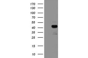 Western Blotting (WB) image for anti-Prenyl (Decaprenyl) Diphosphate Synthase, Subunit 2 (PDSS2) antibody (ABIN1500137) (PDSS2 Antikörper)