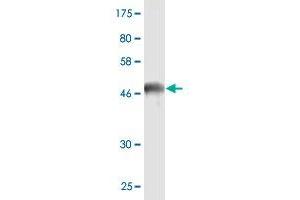 Western Blot detection against Immunogen (47. (HSPB8 Antikörper  (AA 1-196))