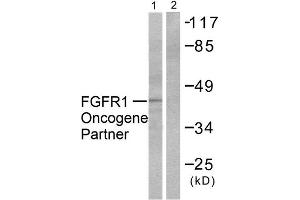 Western Blotting (WB) image for anti-FGFR1 Oncogene Partner (FGFR1OP) (C-Term) antibody (ABIN1848539) (FGFR1OP Antikörper  (C-Term))