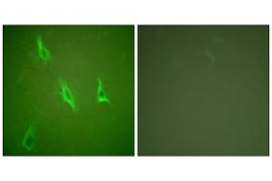 Immunofluorescence analysis of HeLa cells, using Caspase 10 antibody. (Caspase 10 Antikörper  (C-Term))