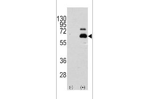 Western blot analysis of RPS6KB1 using rabbit polyclonal RPS6KB1 Antibody (S404) using 293 cell lysates (2 ug/lane) either nontransfected (Lane 1) or transiently transfected with the RPS6KB1 gene (Lane 2). (RPS6KB1 Antikörper  (AA 405-434))